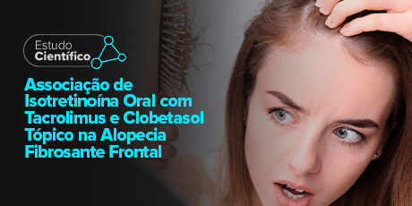 Associação de Isotretinoína Oral com Tacrolimus e Clobetasol Tópico na Alopecia Fibrosante Frontal