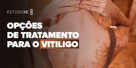 Opções de Tratamento para o Vitiligo