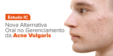Nova Alternativa Oral no Gerenciamento da Acne Vulgaris