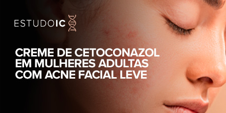 Creme de Cetoconazol em Mulheres Adultas com Acne Facial Leve
