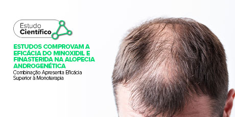 Minoxidil e Finasterida na Alopecia Androgenética