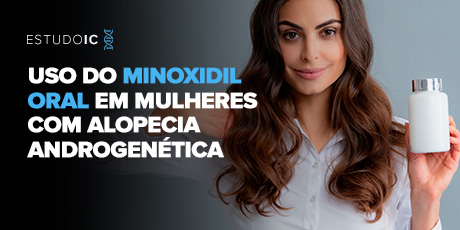 Novo Estudo Demonstra o Uso do Minoxidil Oral em Mulheres com Alopecia Androgenética